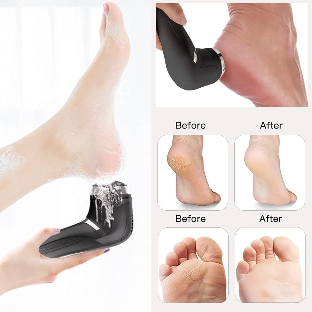 Portable and Rechargeable Electric Foot File Foot Callus Remover, Foot Grinder Professional Pedicure Tools with 3 Rollers And 2 Speeds